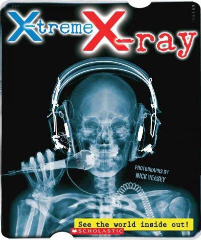 X-Treme X-ray: See the World Inside Out!